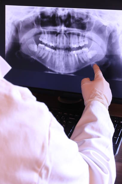 Emergency Dental Filling Replacement in AL